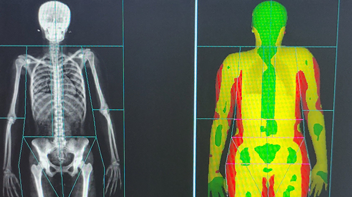 nyit's tweet photo. Our Center for Esports Medicine has announced an exciting, new research collaboration with @GEHealthcare to analyze competitive gamers' lean body mass and help establish the first esports body composition benchmarks.
https://t.co/vi8gfGkUTv https://t.co/LRn6sjgRIs
