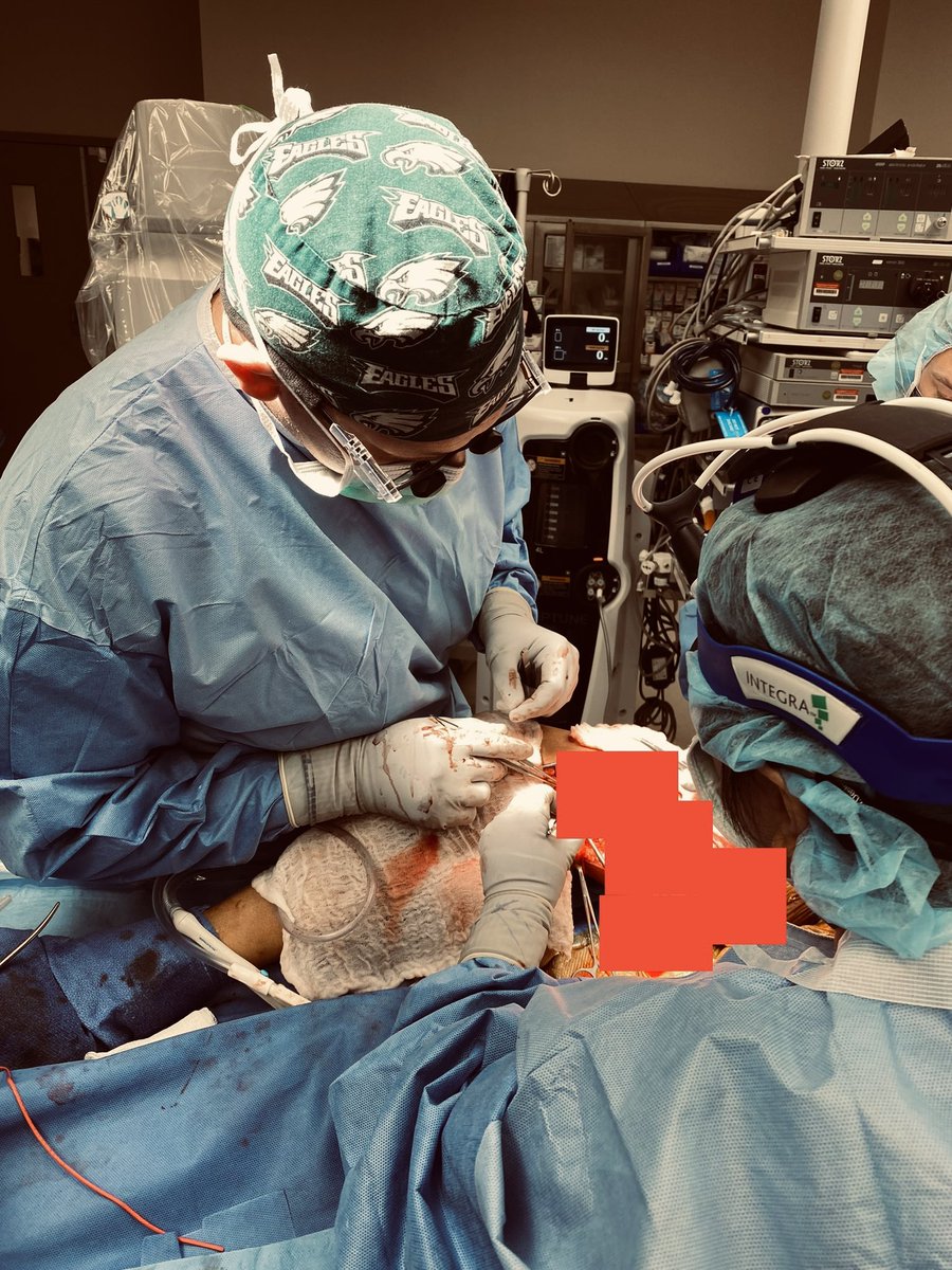 <a href="/Drewmergency/">Drew Zebley</a> may have his heart set on trauma <a href="/traumadoctorsam/">AAST Associate Members</a>, but he knows his way around a Castro. Here sewing the distal on a redo fem-pop. Our chiefs and residents get an amazing hands on vascular surgery experience both open and endo! <a href="/GWSurgery/">GW Surgery</a>