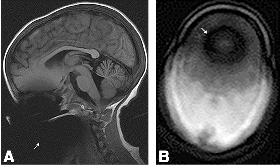 Neurographics tweet media
