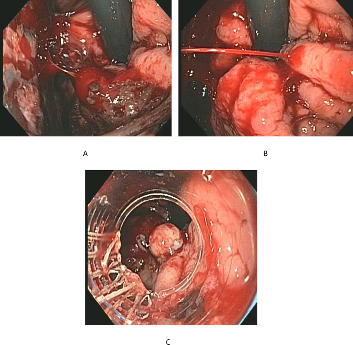 FrontGastro_BMJ's tweet photo. Read the excellent latest issue of @FrontGastro_BMJ online now via

https://t.co/X773eQ9hyg

or via

https://t.co/rga3mcdEXQ

#IBDTwitter #LiverTwitter #EndoTwitter #GITwitter #UEGWeek22 @RMBeattie50 @OTavabie @Dr_Dee_Kumar @drobeirne @AusDrGupta @jennie_clough @DCharabaty https://t.co/0kPI5y7o1E
