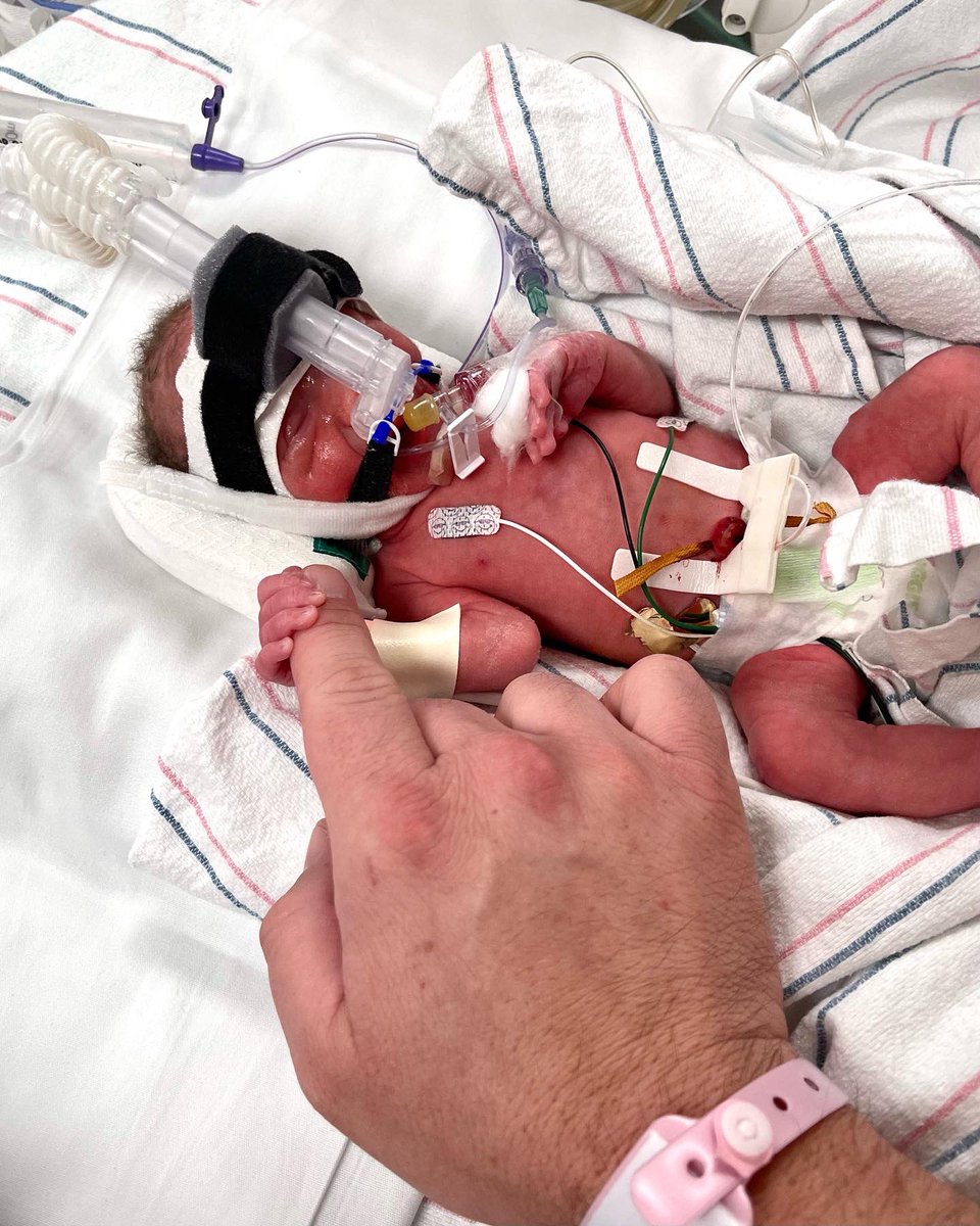 What a difference a year makes.

Happy birthday, Everleigh.