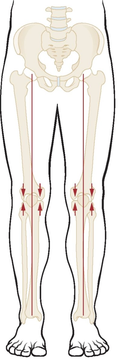 PasionAnatomia's tweet photo. El #EjeDeCarga del #MiembroInferior se encuentran en una línea recta imaginaria que conecta el centro de la #CabezaDelFémur en la articulación de la #cadera y el centro de la mortaja tibioperonea en la articulación #talocrural. https://t.co/dCbhF9skd0