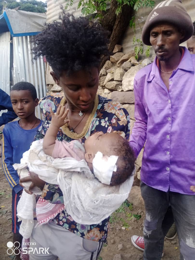 FsgJew's tweet photo. The situation in 🇪🇹 is spiraling out of control.
Civilians are paying a horrific price.
Hostilities in #Tigray must end now
immediate withdrawal &amp; disengagement of 🇪🇷|n forces from 🇪🇹.
#StopWarOnTigray
@SFRCdems @HouseForeign 
@SenateForeign @JosepBorrellF @UN_HRC @UKParliament https://t.co/E2WFGD3dai