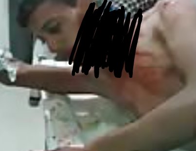 Diamond85553574's tweet photo. Guys neck bleeding Blurring draw photo https://t.co/sazrLX3DS4