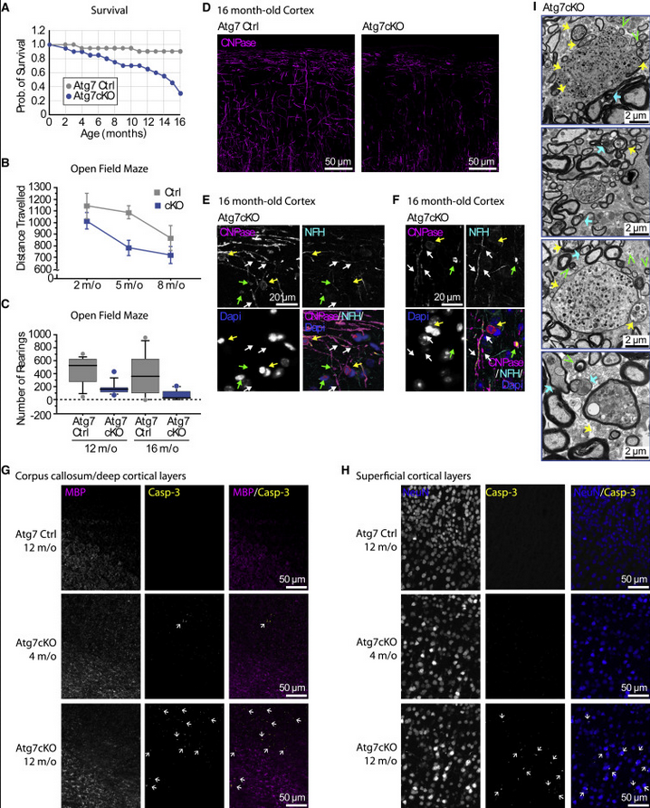 ScienceofPD's tweet photo. You know how oligodendrocytes have become a thing in #Parkinsons with all of the single cell seq work on post mortem tissue?

New research finds inactivation of macroautophagy in oligodendrocytes leads to behavioral dysfunction &amp; neurodegeneration in mice
https://t.co/Q4xHBnKpGX https://t.co/SZqShht91s