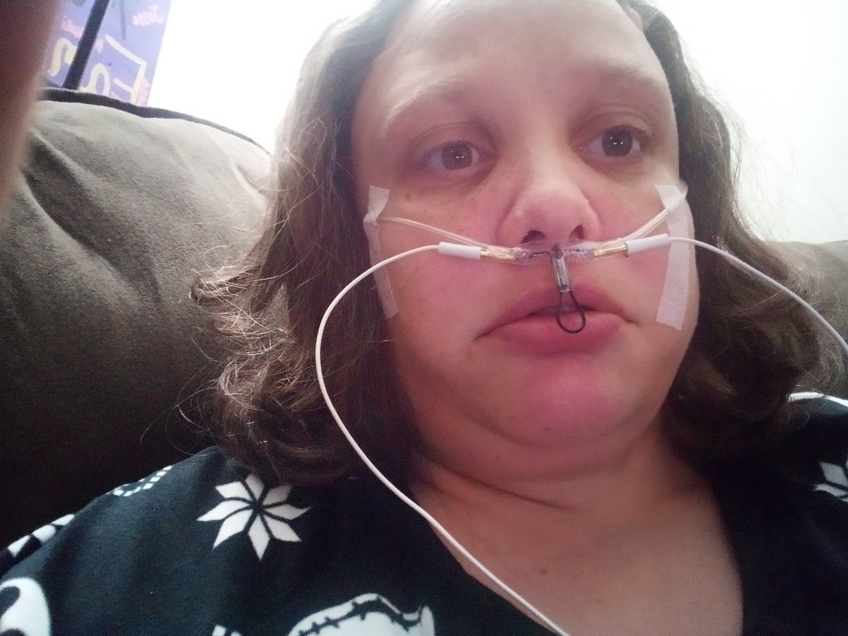 midget474's tweet image. Doing a sleep test😴 I lookin like a crab