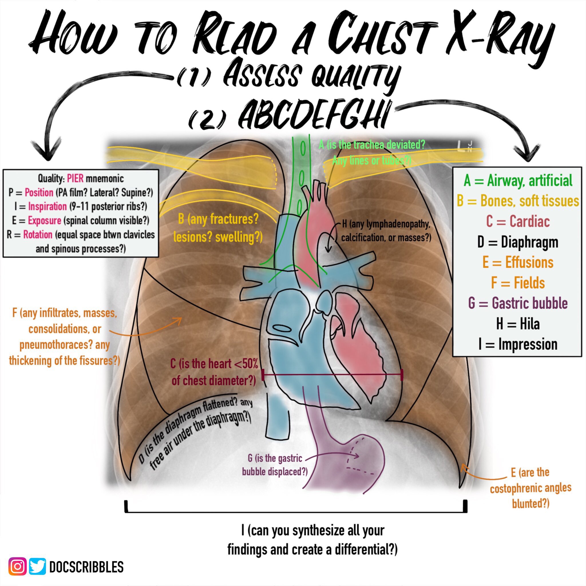 Top Biomedical Science on Twitter "How to read a Chest XRAY DocScribbles pulmonary 