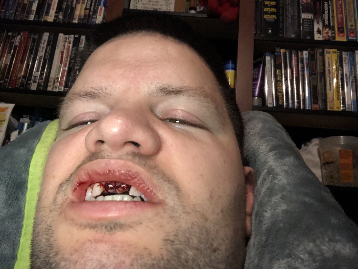 Rockynohands tweet media