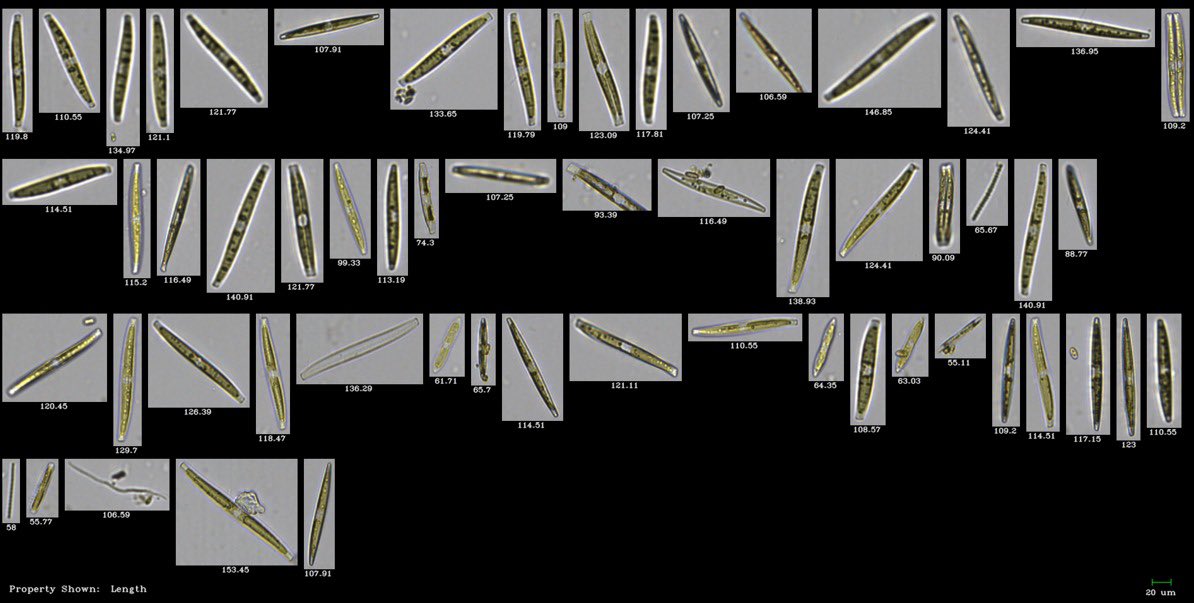 plancton_andino's tweet photo. Benthic estuarine pennade diatoms. They move very actively in sediments mats #pucatrihue #contaco #flowcam @postcienulagos @CentroIDEAL_CL @Th_Mock https://t.co/ExhEZEZm7j
