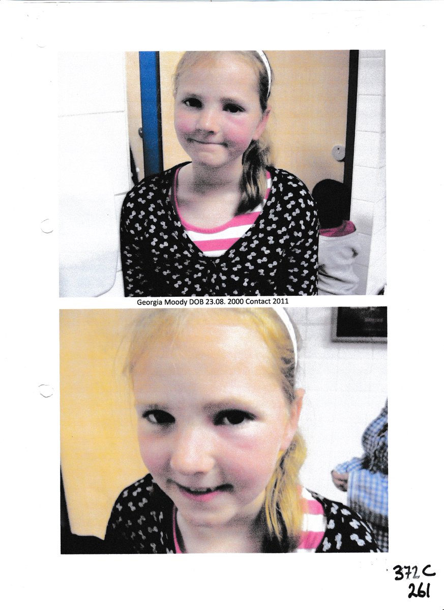 JangledogMellow's tweet photo. She had Stopped Talking

London Royal Courts of Justice
Lord Justice Ryder
Lord Justice MacFarlane
both passed Judgement
that the sick child below
in State Care
should not have her medical records
shared with her mother
nor was her ill health a concern
or worth having a hearing💋 https://t.co/myiEEBpayk
