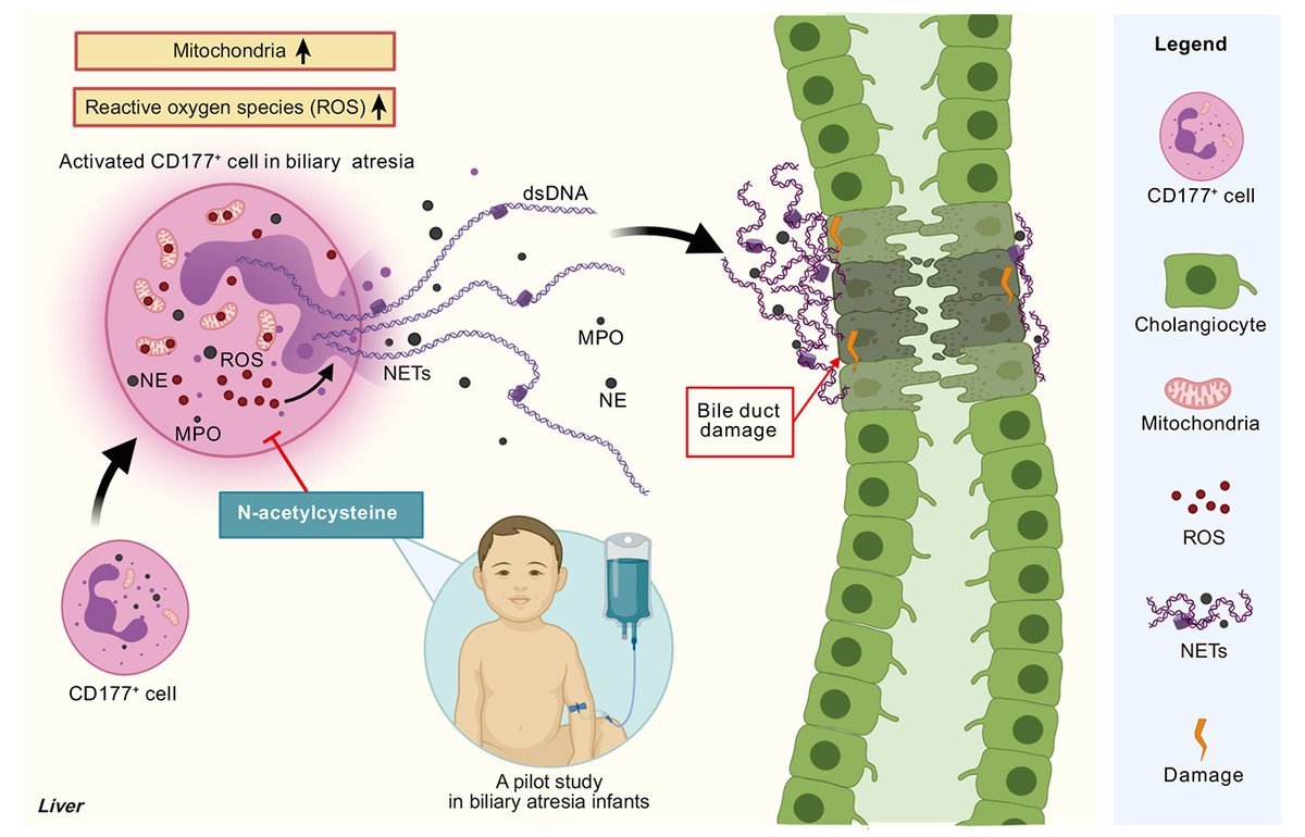 #CD177+ cells
➡️important role in initiation of #BiliaryAtresia pathogenesis via #NeutrophilExtracellularTrap formation

#Nacetylcysteine administration:
⬇️CD177+ cell numbers
⬇️reactive oxygen species levels
✅potential beneficial effect

🔓bit.ly/3acfQG8

#LiverTwitter