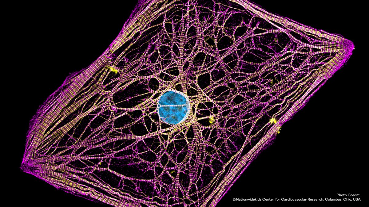 Check out this mesmerizing photo of a heart cell derived from induced pluripotent stem cells from <a href="/Nikonsmallworld/">Nikon Small World</a> 2022 Photomicrography Competition.  

Photo Credit: <a href="/Nationwidekids/">Nationwide Children's Hospital</a> Center for Cardiovascular Research, Columbus, Ohio, USA 

#StemCells #Nikon #Biobanking #Biotech