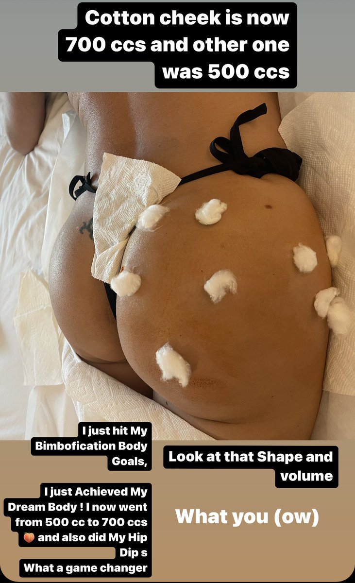 BimboDoll2000 Back in pain and back on pain Meds the things we do to Create our dream Bodies.