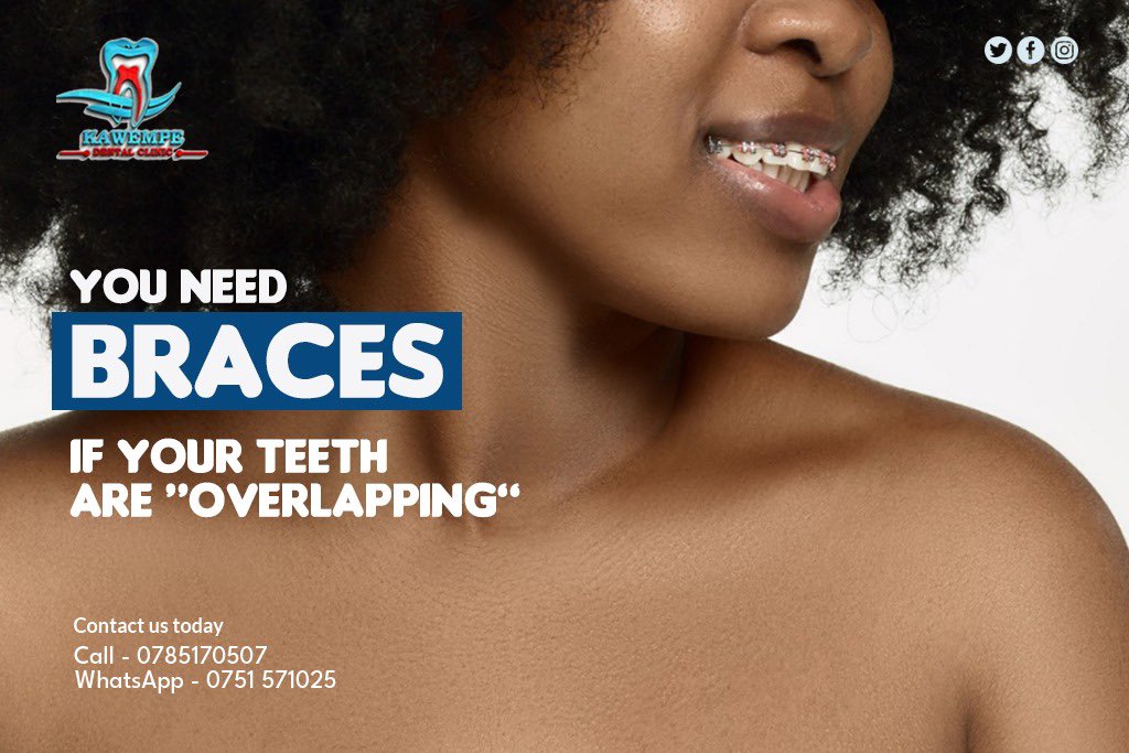 EzzyDigitalUG's tweet photo. Client - @kawempedentalservicesclinic
Campaign - “Braces”
#dentistry #dentalhygiene #dentaltips #knowyourteeth https://t.co/FLbEjVo7cm