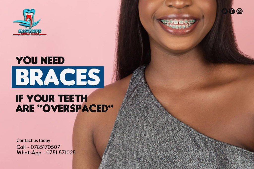 EzzyDigitalUG's tweet photo. Client - @kawempedentalservicesclinic
Campaign - “Braces”
#dentistry #dentalhygiene #dentaltips #knowyourteeth https://t.co/FLbEjVo7cm