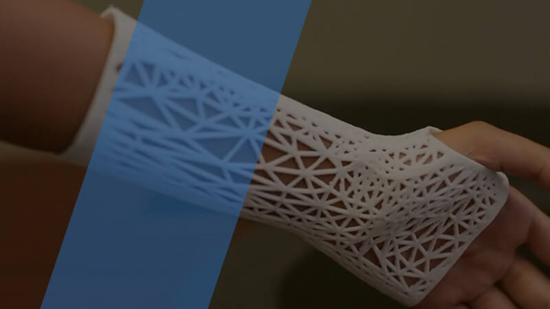 Manideep_IARC's tweet photo. #Medical instruments generated by 3D printing #technology are inclusive of #orthopedic and cranial implants, #surgical instruments, #dental restorations like crowns, and external prosthetics.

For More: https://t.co/pzqiN4nLlH

#3Dprinting #Healthcare #IndustryARC #MedicalDevices https://t.co/XCSDmr30EL