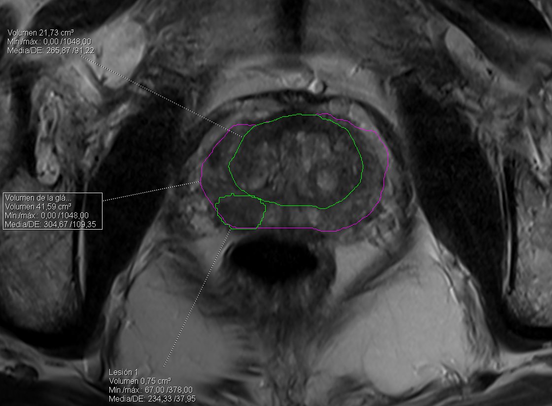 Guille G tweet media