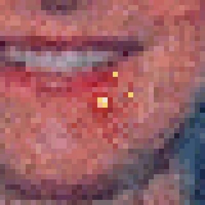 crypto_pimples's tweet photo. This is Crypto Pimple 15264, you may find it at https://t.co/88jGUijJa6 #cryptoPimples https://t.co/fjNWhkAGgz