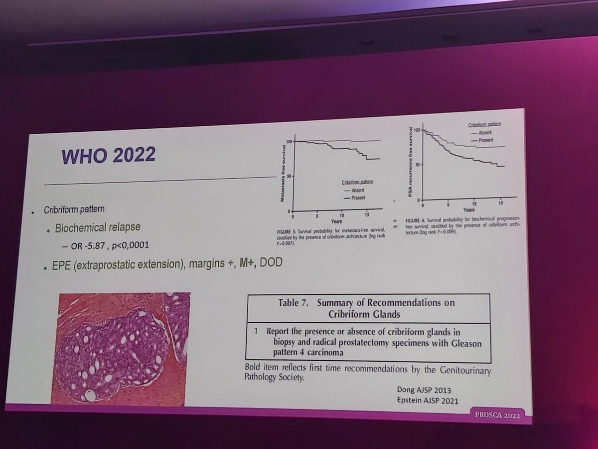 @evacomperat on the updated #WHOGuidelines2022 - its variants not sub-type, cribriform is prognostic, molecular pathology expertise is increasingly important for optimal patient outcomes #PROSCA22 @mirrorsmed