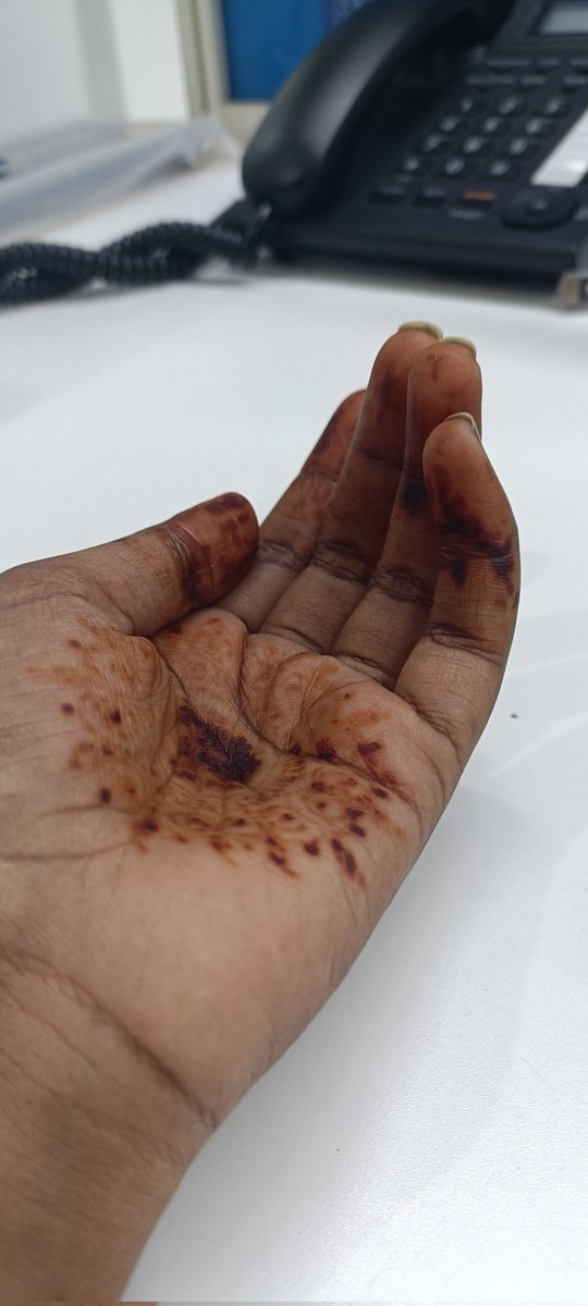 mildbluefem's tweet photo. #funniesttweets #henna
#beautymemes #indianthings #desitweets  #indianmemes #viral 

Nobody:
Modern Mehndi/henna designs after 3-4 days of application: https://t.co/B1BME5TeYQ
