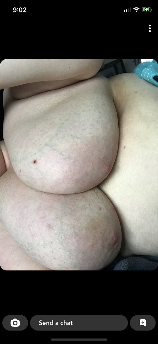 IllsayYessss's tweet photo. Everyone who retweets this and follows me gets another pic in their dms. #freetits #exposed #exposedslut #exposedwhore #webslut #hugetits #leakedsnapchat https://t.co/ZyJ2tZW7oL
