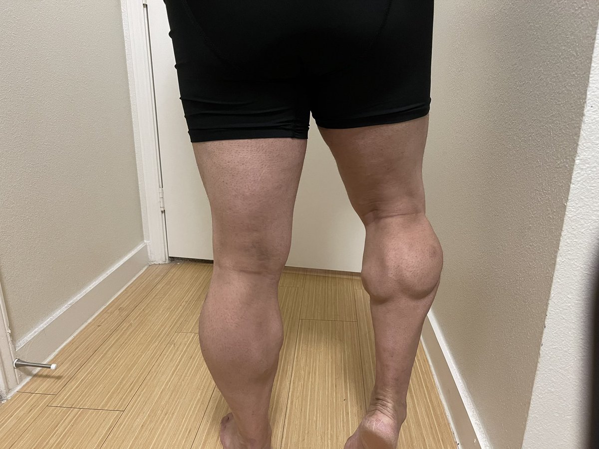 Herculegstx's tweet photo. #menslegs #legs #legmuscles #legpump #calves #quads #hamstrings #malelegs https://t.co/p63oIepGi5