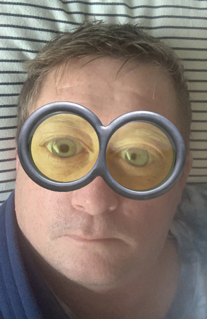 Mmmichmatch's tweet image. Just boring being home..
Gaaaah
#postoperation #boring #gah #meh