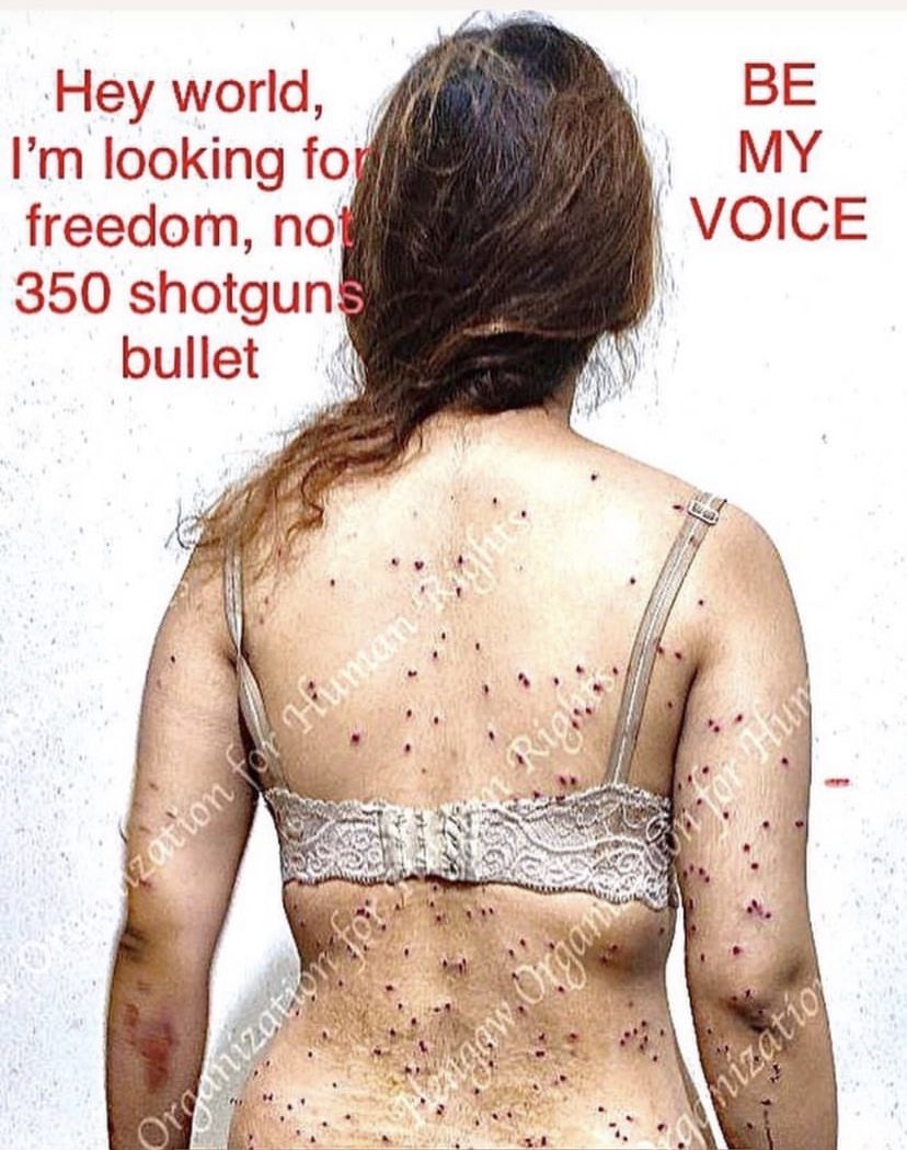 FreeIran2022USA's tweet image. #MahsaAmini #StopHazaraGenocide #ukraine