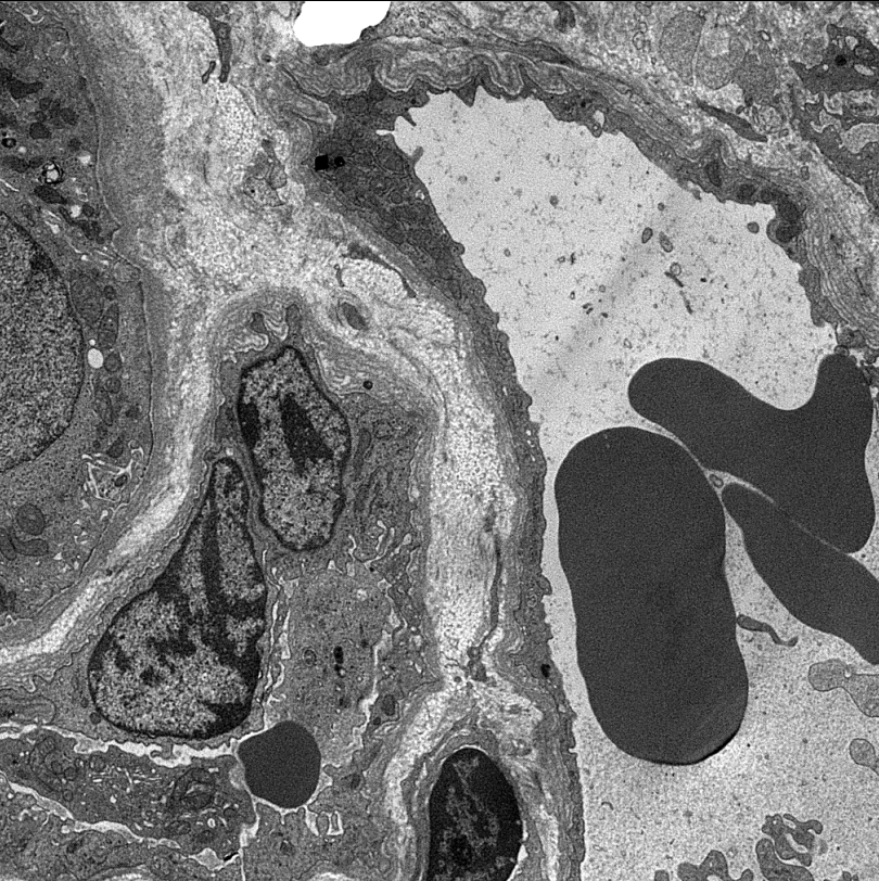 Jonathan Zuckerman MD PhD on Twitter 