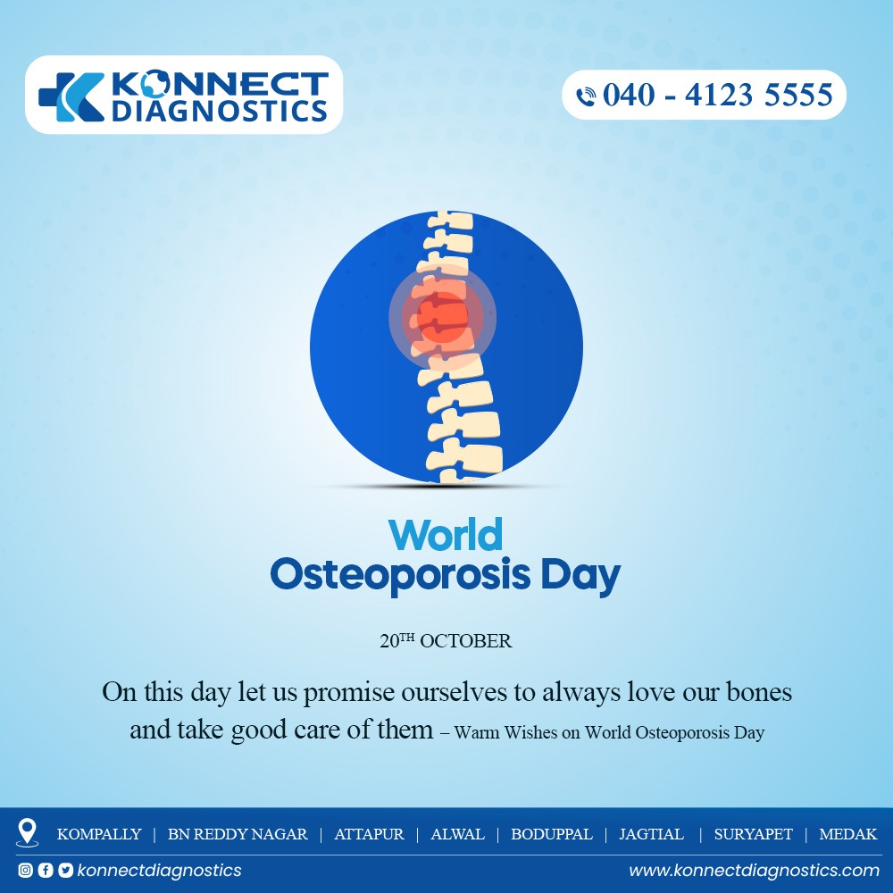 KonnectDiagnos2's tweet photo. On this day let’s remember to take good care of our bones and secure our healthy future – Warm Wishes on World Osteoporosis Day

#osteoporosisday #worldosteoporosisday #osteoporosisexercise #konnectdiagnostics #diagnostics https://t.co/Jq5tX0ps8s