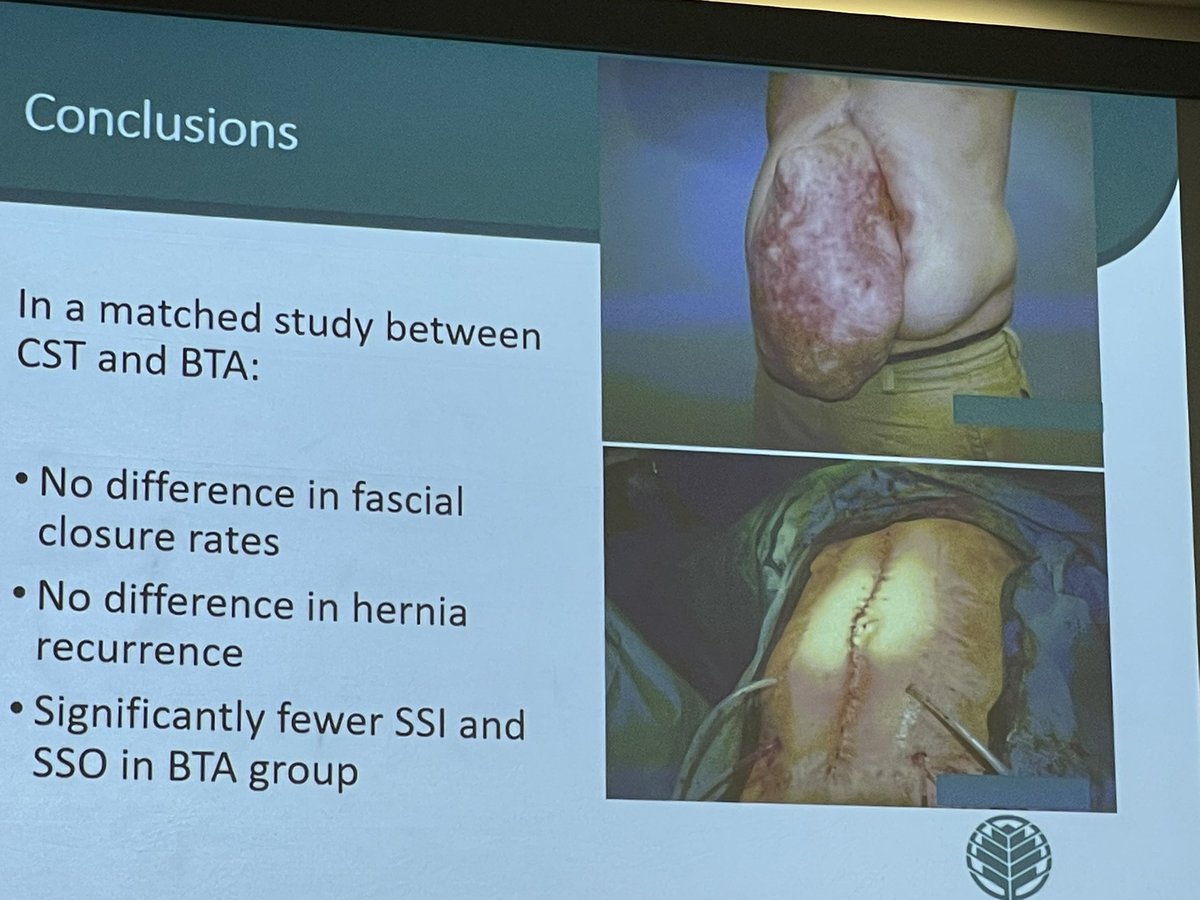 Herniadoc's tweet photo. This is great information: #Botox injection may be just as good as surgical #componentseparation in allowing for fascia closure in large #incisionalhernias.
Nice presentation by Carolinas Hernia Center group @THeniford @VedraAugenstein presented by @MarturanoMd
@EhsManchester https://t.co/YmvcUc6SHt