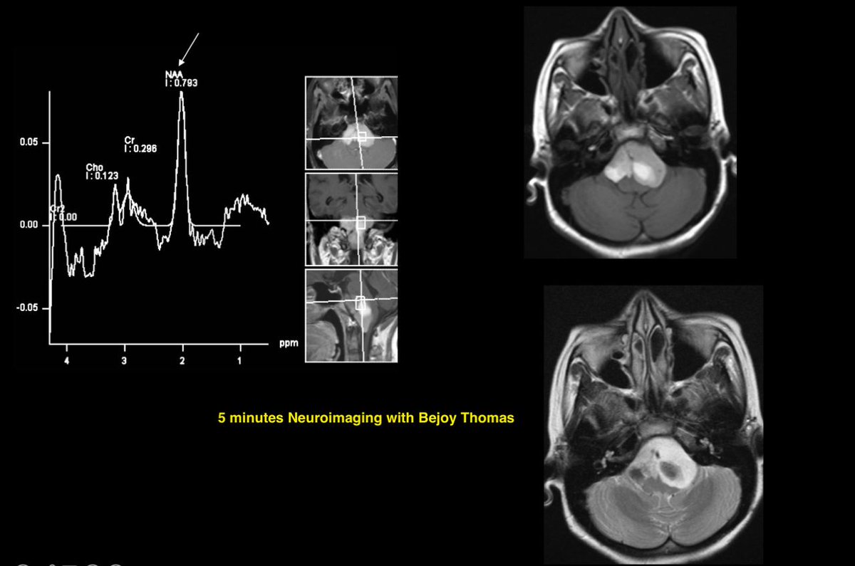 drbejoy2002's tweet photo. Case 4, what's the most likely internal lining of this lesion? https://t.co/Z22VxV5Tah