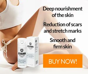HealthMarts's tweet photo. Contains extracts, vitamins and oils that improve the condition of the skin on the abdomen, thighs, buttocks and arms. 
https://t.co/KwuUidiMA8
 #stretchmark #skincare #stretchmarkcream #stretchmarks #stretchmarkremoval #antiaging #jerawat #glowing #healthfitnessmarts https://t.co/uSr3ZfIOpY