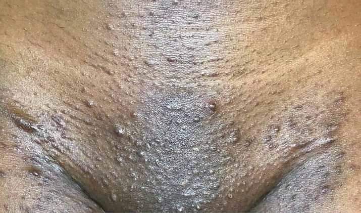 ItsTheReal_BizZ's tweet photo. Besides shaving, 🤔 what causes that to happen? #Healing #OpenForDiscussion https://t.co/28TIgvaNGe