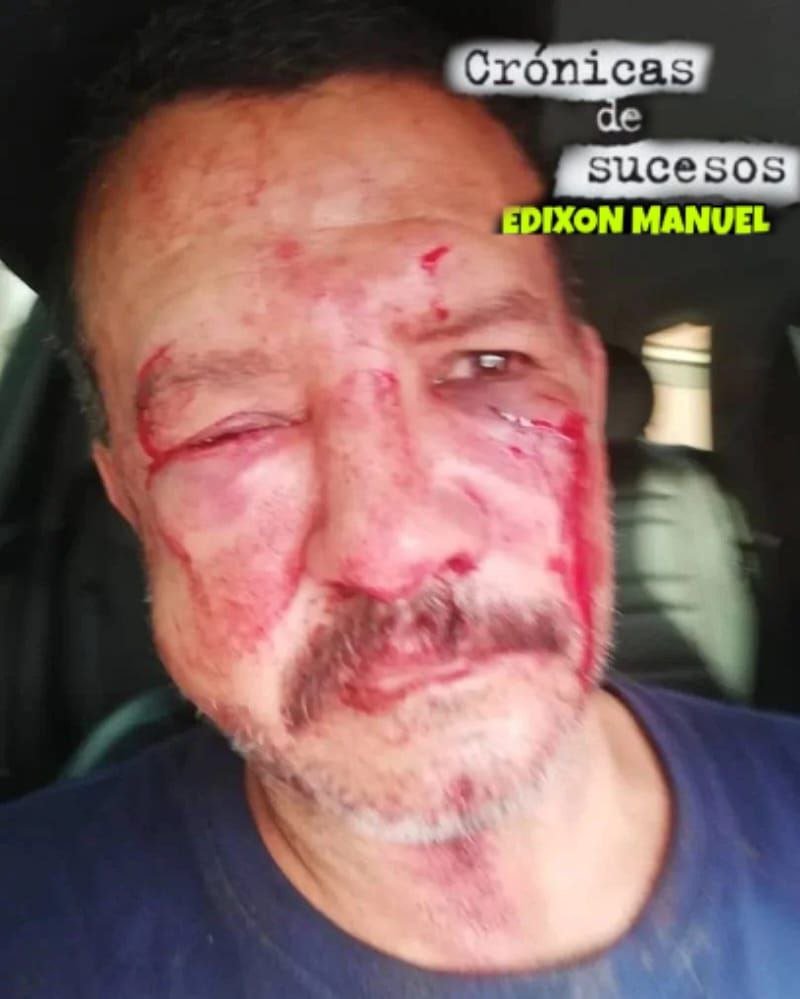 InforTvenezuela's tweet photo. Vladimir López denuncia golpiza de parte de Evelis López funcionario del SEBIN,Barquisimeto,edo Lara.
La esposa de Evelis es inquilina de un local del sr Lopez, el domingo el los mando a cerrar temprano,esto causó molestia.
La denuncia esta en Cicpc y fiscalia,No ha pasado nada https://t.co/UZPTDhW9gi