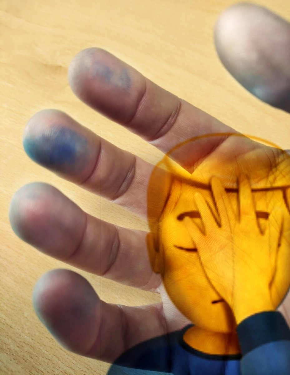 Really enjoyed teaching my first tutorials today.

Definitely learnt not to assume the room will have a functioning Whiteboard eraser.

Apologies to the next room booker if you can still see the remnants of my tropylium ions, but, I promise, most of them are on my fingers.🤦‍♂️