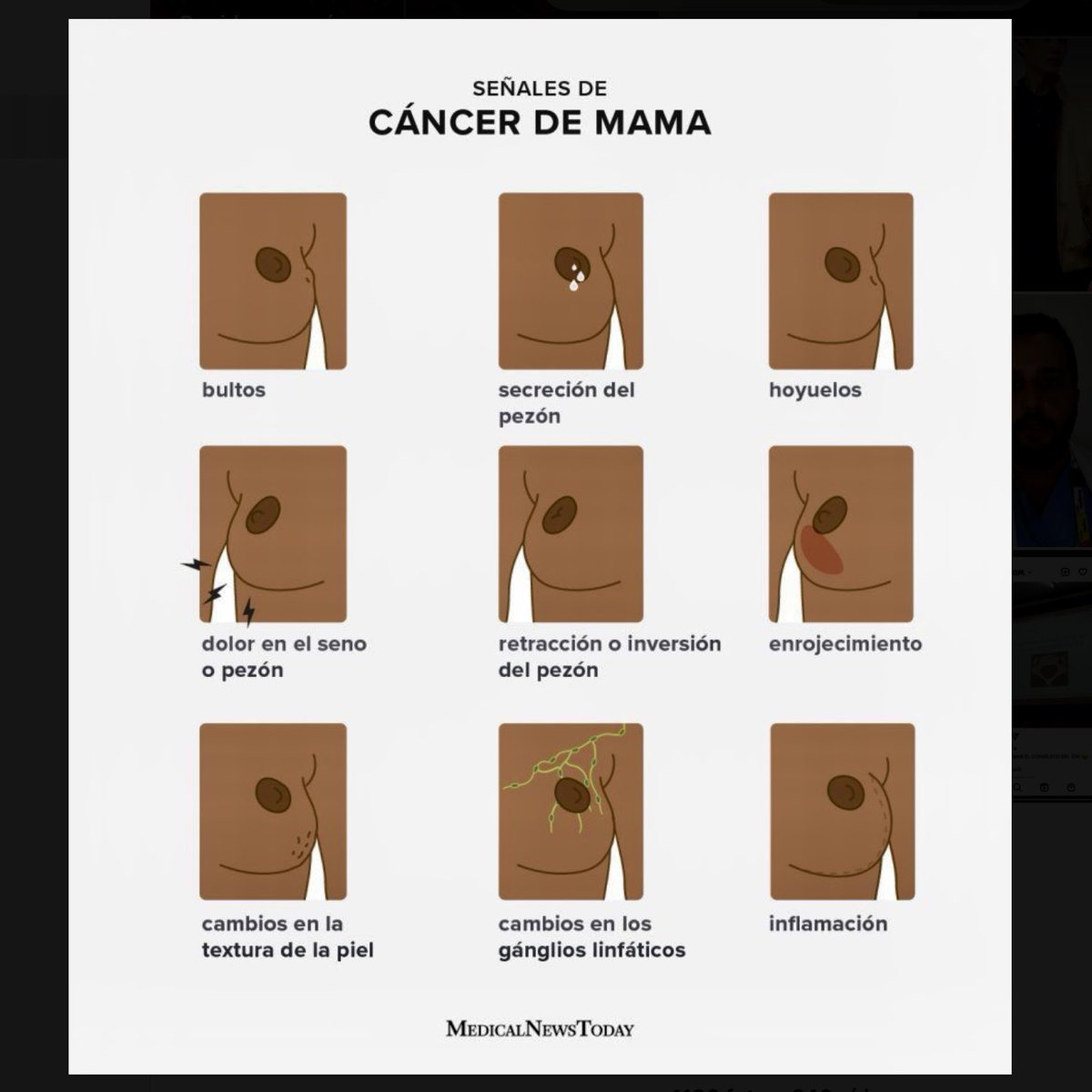 EnfrmraSaturada's tweet photo. 🏥 Si aparece alguno de estos cambios no hay que ponerse en lo peor, muchos de estos síntomas pueden estar causados por otros problemas de salud, pero es importante descartar el cáncer como posible causa y por eso se debe consultar siempre.⁣

#DiaMundialDelCancerDeMama https://t.co/9FzlXEey0b