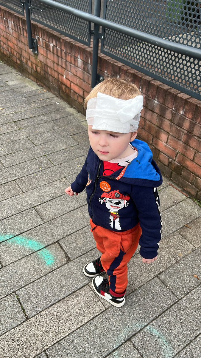 marauder_potter's tweet photo. So griffin had a fight with a concrete slab and lost π€¦πΌββοΈ letβs hope we can cheer him up with a @ClanIHC win tonight π€@Shaunski15 #toddlers #bumpedhead https://t.co/Kh2P2gyK6x