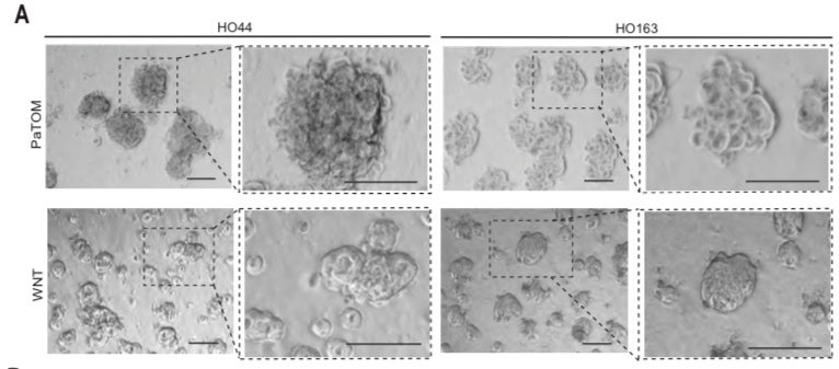 Anirban Maitra (@aiims1742) on Twitter photo Important preclinical study in <a href="/JCI_insight/">JCI insight</a> from <a href="/MayoClinic/">Mayo Clinic</a> team:
Culture media composition influences patient-derived organoids ability to predict therapeutic response in gastrointestinal cancers (#PancreaticCancer, #ColorectalCancer)
insight.jci.org/articles/view/…
Mind your media! Important preclinical study in <a href="/JCI_insight/">JCI insight</a> from <a href="/MayoClinic/">Mayo Clinic</a> team:
Culture media composition influences patient-derived organoids ability to predict therapeutic response in gastrointestinal cancers (#PancreaticCancer, #ColorectalCancer)
insight.jci.org/articles/view/…
Mind your media!