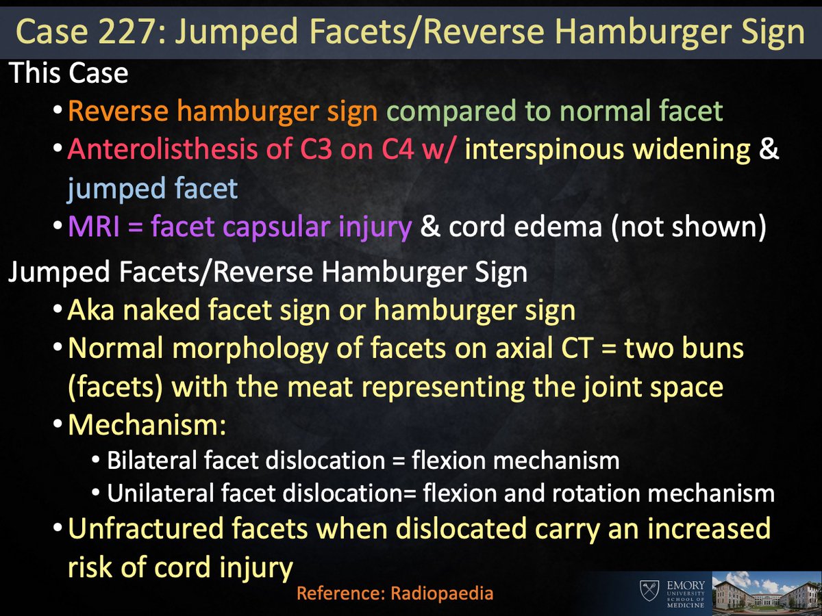 Answer: Jumped facet (hamburger sign) Aka naked facet, reverse hamburger bun, locked facet. Should be able to recognize on axial but as @BrentWeinberg pointed out, why bother. He always starts with the sagittal. #EmoryRadCOTD