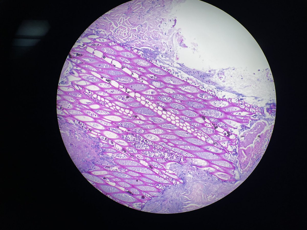kikburke's tweet photo. Fun little nugget this AM! Thanks for your help @JMGardnerMD  https://t.co/ay25raMeek https://t.co/it8jj6VwNf
