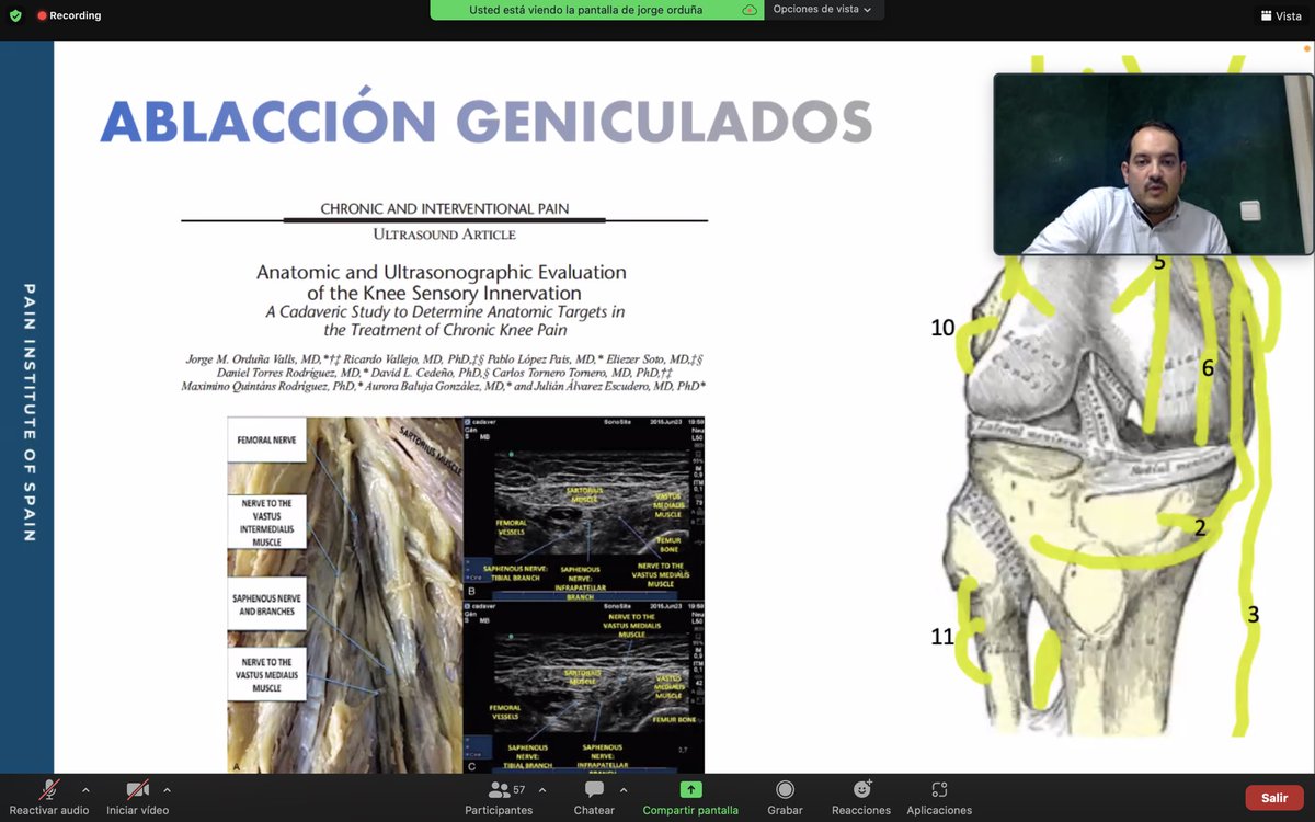 pios_institute's tweet photo. Magníficas exposiciones sobre el tratamiento intervencionista en grandes articulaciones. Enhorabuena a @ordu1001 @DraSaraArangoU y #alejandroortega por sus ponencias y al moderador @ChusMoraga #pios #dolorarticular #paineducation https://t.co/bQ3cBVLst6