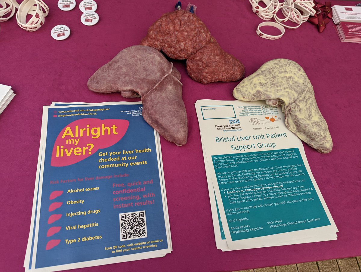 Bristol Royal Infirmary Liver Unit (@briliverunit) on Twitter photo Great work team! <a href="/AnnieArcher/">Arise 🍊$30 🍊ONLY</a> @sally_t_25 and Grace Cameron representing the Bristol Royal Infirmary today at the <a href="/LiverTrust/">British Liver Trust</a> ‘Love Your Liver’ roadshow in Bristol.
Public engagement offering liver health advice and screening is the key!
 
#LoveYourLiver Great work team! <a href="/AnnieArcher/">Arise 🍊$30 🍊ONLY</a> @sally_t_25 and Grace Cameron representing the Bristol Royal Infirmary today at the <a href="/LiverTrust/">British Liver Trust</a> ‘Love Your Liver’ roadshow in Bristol.
Public engagement offering liver health advice and screening is the key!
 
#LoveYourLiver