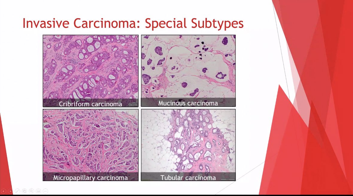 BreastRadFellow's tweet photo. 🔬🔬@LaurenERosenMD from @UCincyPath reviewed breast pathology of MALIGNANT lesions and covered all the high yield information!! 

We learned so much from her expert pathology perspective 👏🏽🙌🏽. Thank you for teaching us!! https://t.co/2txAX2W4eR