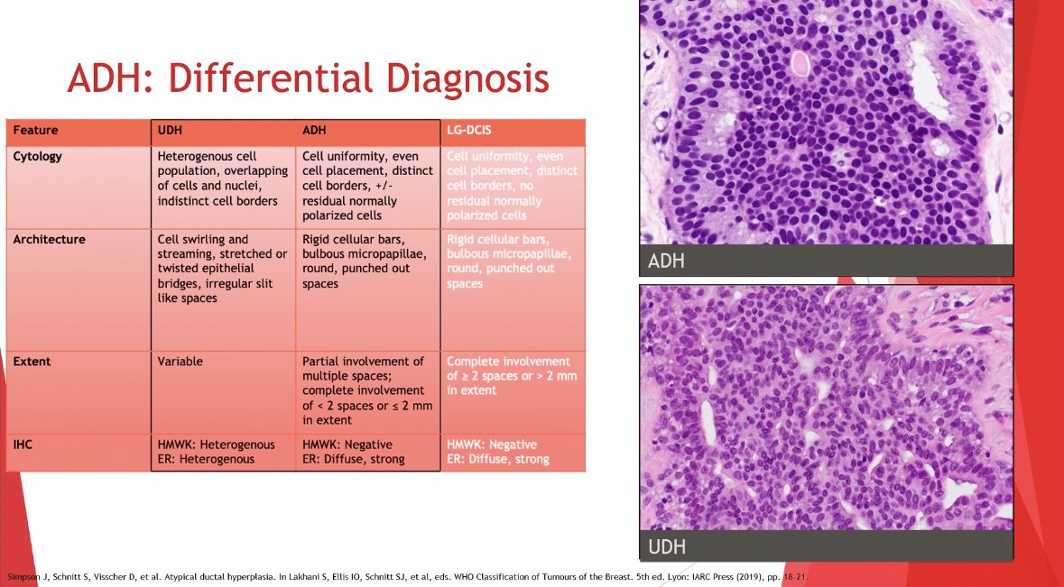 BreastRadFellow's tweet photo. 🔬🔬@LaurenERosenMD from @UCincyPath reviewed breast pathology of MALIGNANT lesions and covered all the high yield information!! 

We learned so much from her expert pathology perspective 👏🏽🙌🏽. Thank you for teaching us!! https://t.co/2txAX2W4eR