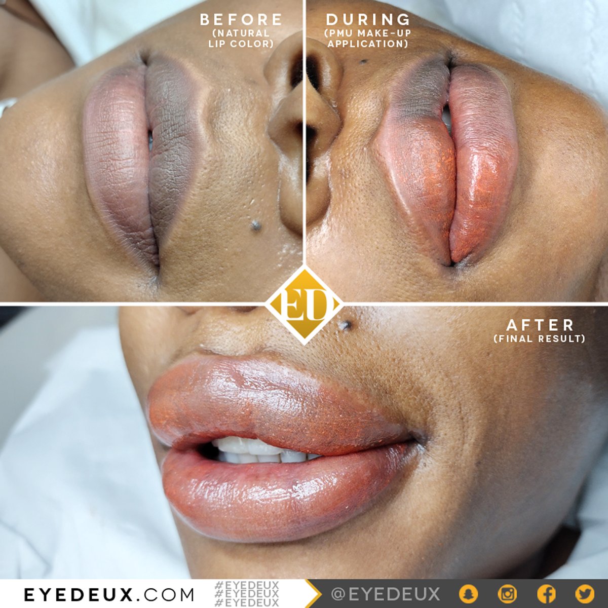 EyeDeux's tweet photo. Want to color correcr your #LIPS? Try #LIPNEUTRALIZATION 👄
The right shade can ENHANCE your NATURAL LIPS + DEFINITION.
Ready for your Lip Tattoo? Make your APPOINTMENT ONLINE @ https://t.co/n7PViBRO3w. 📲
#EyeDeux #EDASB #lipblush #lipcolor #liptattooing #liptattoo #pmu https://t.co/X702yJI94I