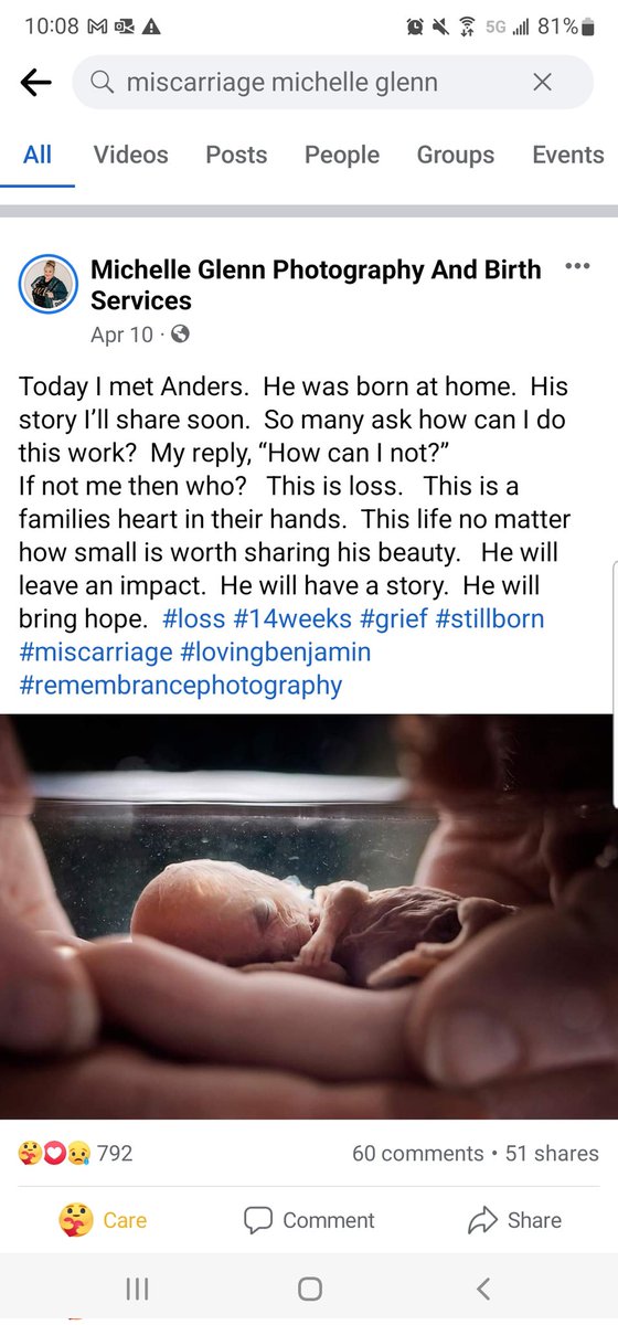 TruthAgape's tweet photo. This is what pregnancy loss looks like. The tiny body of a son held with love and desperate longing for just one more moment together. https://t.co/9LHEaP9t2P