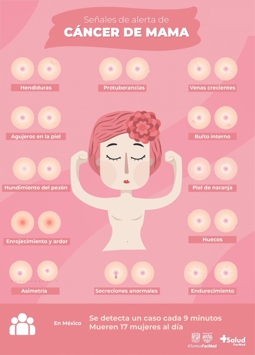 FacMedicinaUNAM's tweet photo. #DíaMundialContraelCancerdeMama  La prevención primaria del cáncer de mama consiste en evitar el sobrepeso y la obesidad mediante un estilo de vida saludable, mientras que la prevención secundaria consiste en la detección temprana. 🚺 https://t.co/wK6Mhf1HDF