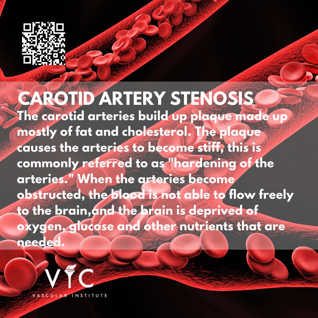 To learn about our team & how we can help: bit.ly/3enZFCT
#VICOctober #VIC #VICVascular #Veins #Endovascular #ArteryDisease #FLOW #VascularSurgery #VaricoseVeins #PAD #CAS #RAS #Aneurysm #Arterial #CLI #CLIFighter #Carotid #Peripheral #Renal #Atherosclerosis #Plaque