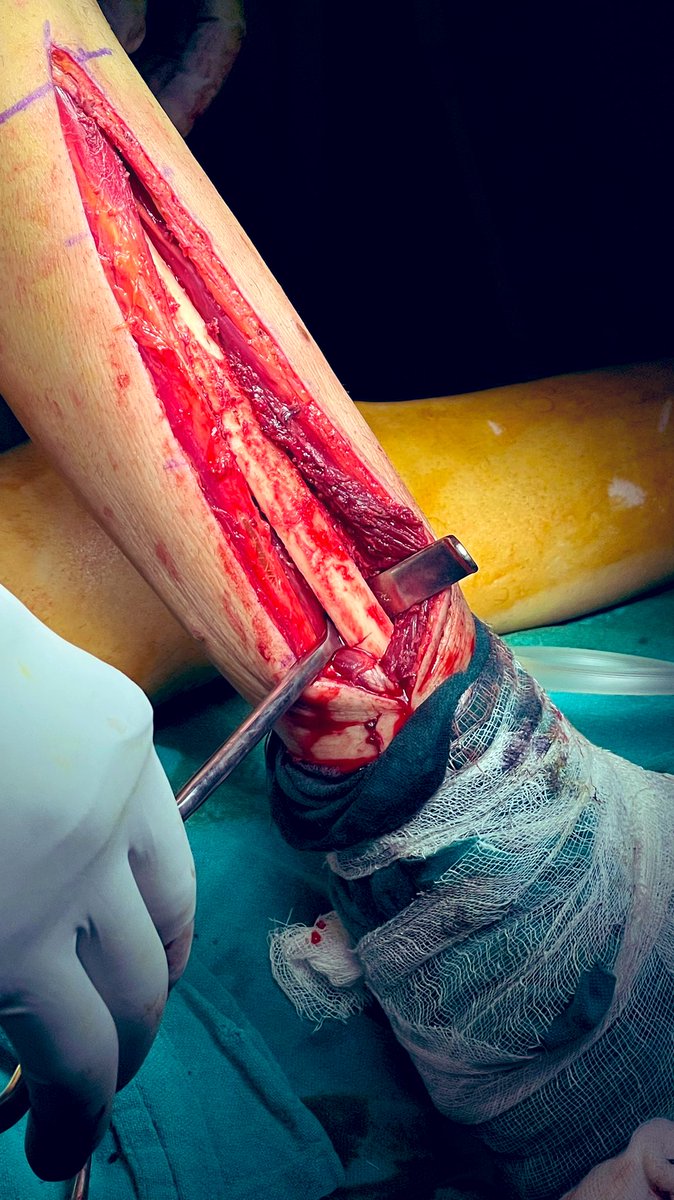 Dr Himanshu Verma tweet media